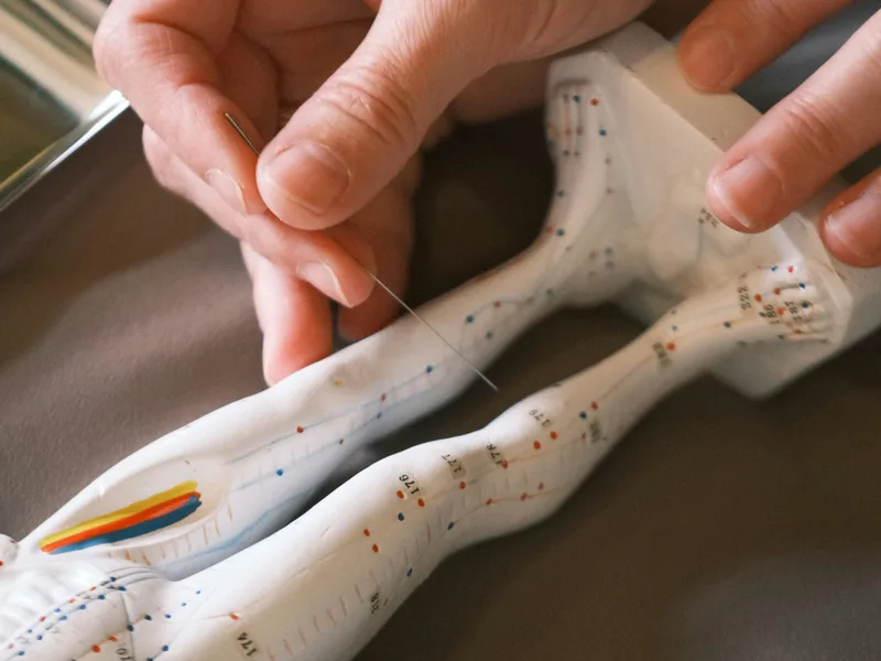 Acupuncture at Carlisle Spine And Wellness in Carl Isle