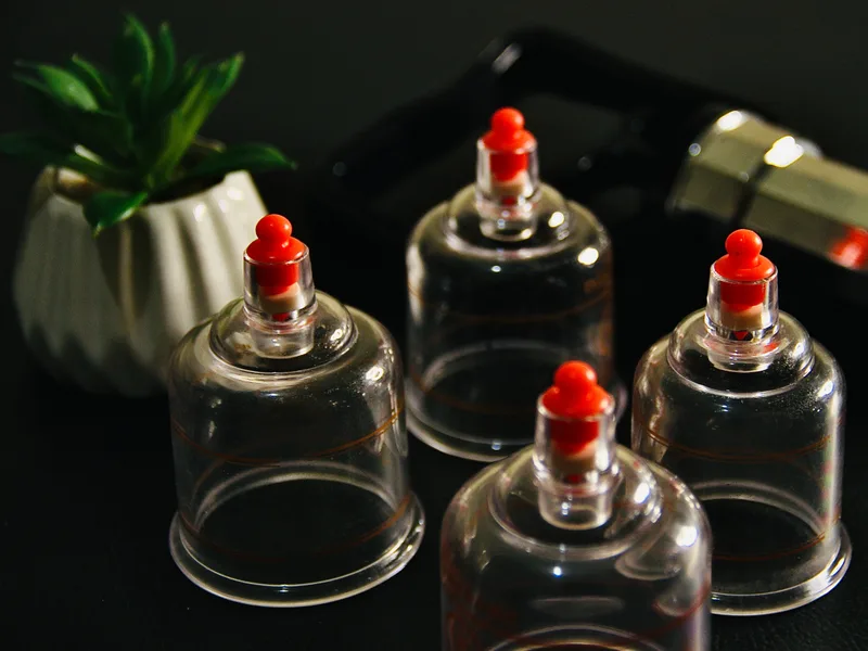 How Cupping Therapy works at Carlisle Spine And Wellness