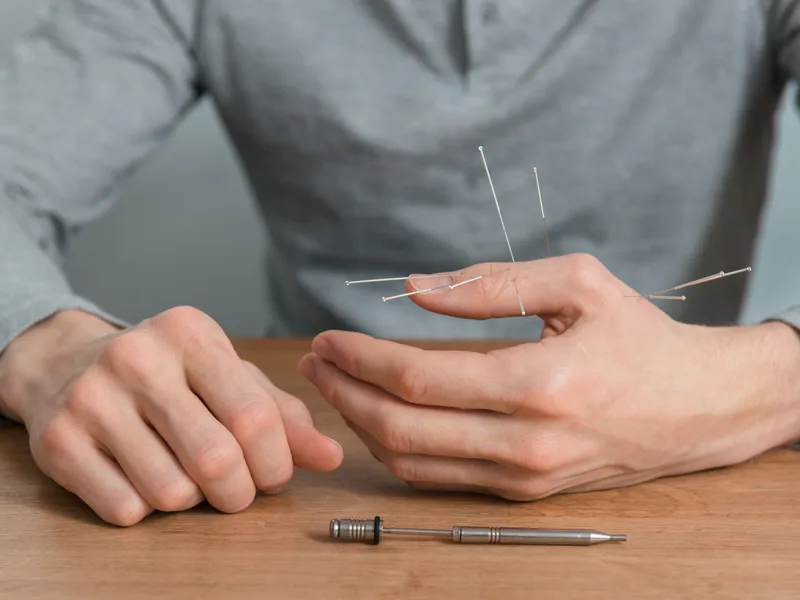 Dry Needling at Carlisle Spine And Wellness in Carl Isle
