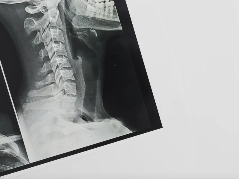 X-Rays at Carlisle Spine And Wellness in Carl Isle
