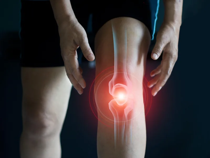 How Carlisle Spine And Wellness treats arthritis in Carl Isle